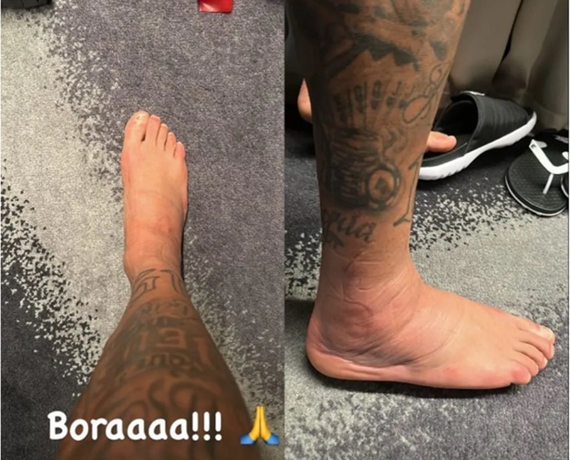 Neymar posta foto de tornozelo inchado e preocupa torcedores