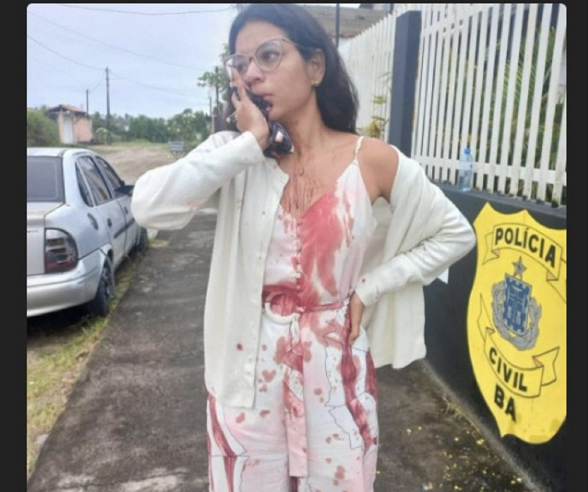 Jovem é esfaqueada no rosto enquanto dormia dentro de ônibus; vítima viajava de Recife para Salvador