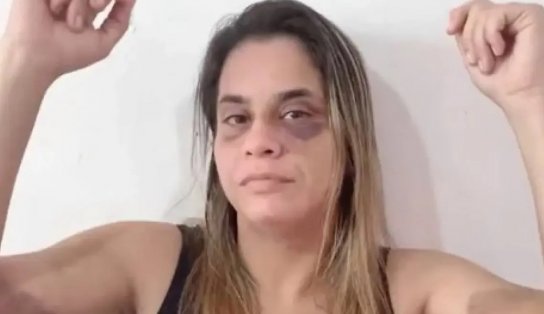 Mulher torturada e agredida com espada de samurai fala com exclusividade ao Cidade Aratu; assista