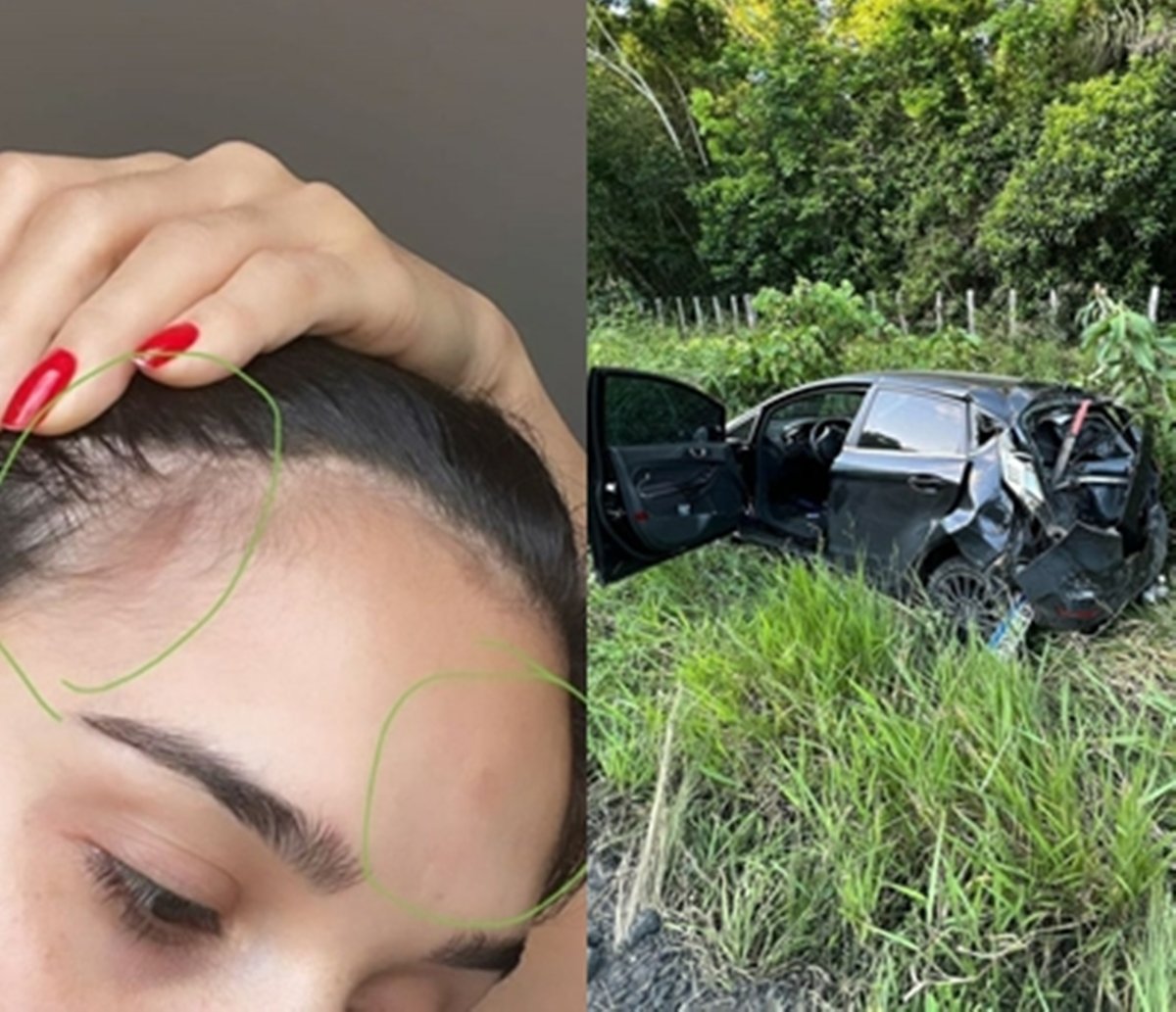 Ex-BBB Gizelly Bicalho sofre acidente e mostra carro destruído; "mais um milagre"