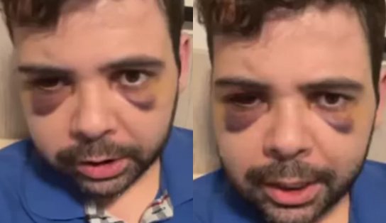 Polícia Civil desmente versão de humorista sobre assalto e agressão