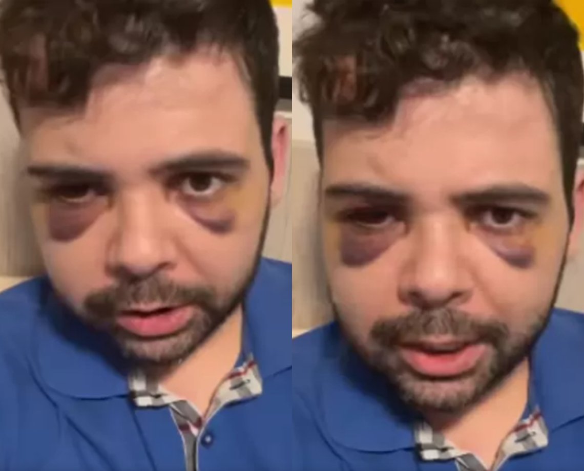 Polícia Civil desmente versão de humorista sobre assalto e agressão