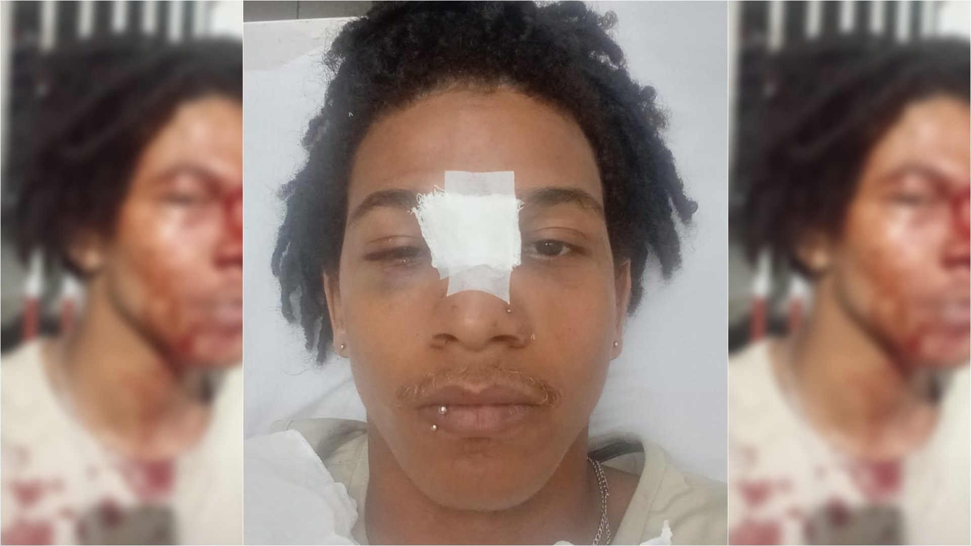 Após agressões, homem acusa PM e funcionário de supermercado em Salvador de racismo