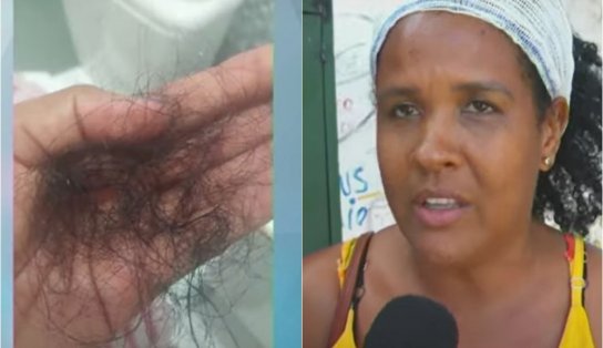 'Tenho medo de morrer', declara mulher agredida com uma barra de ferro pelo ex-marido