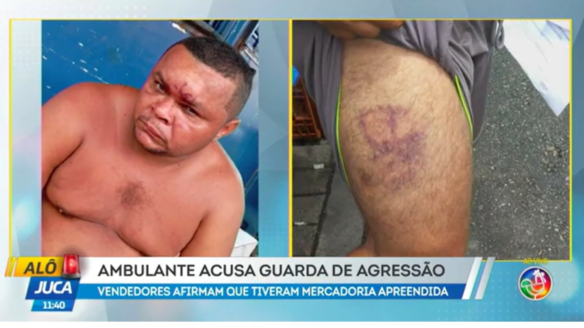 Ambulante denuncia agressão cometida pela Guarda Municipal: 'Me deixaram no chão'