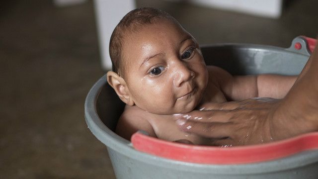 BOLETIM MICROCEFALIA: Casos da doença aumentam em todo o país; Nordeste lidera ranking