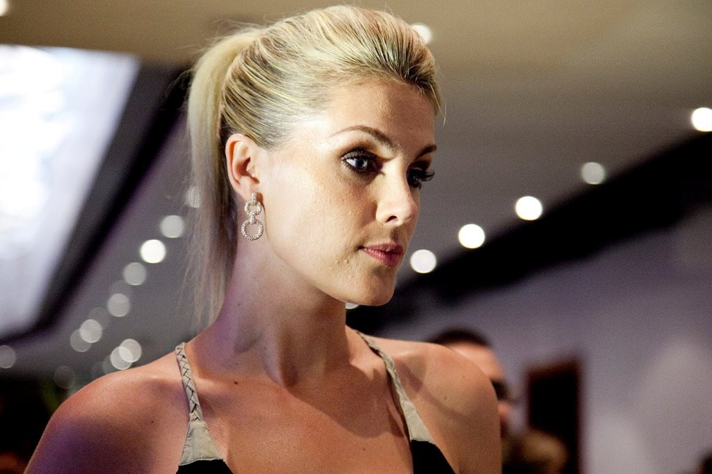 Ana Hickmann desabafa após atentado: ?Nunca pensei que isso poderia acontecer!?