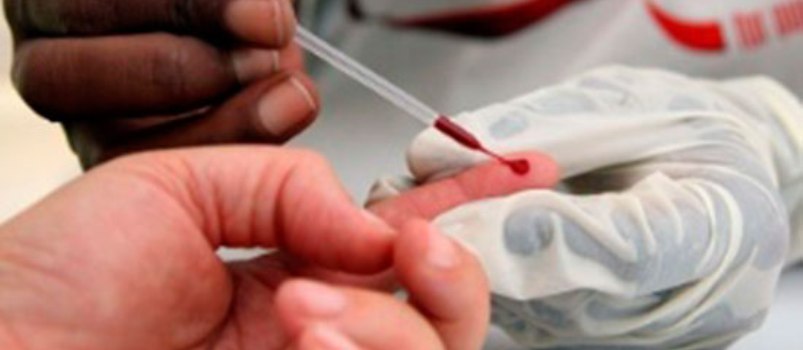 Indústria nacional desenvolve genérico de medicamento para prevenção do HIV