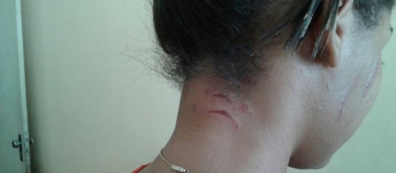 BAIXO NÍVEL: Jovem é agredida e tem cabelo cortado após ser acusada de &#8216;roubar&#8217; namorado