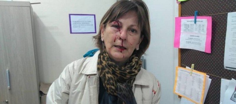 SANTA CATARINA: Professora é agredida por aluno e publica desabado no Facebook