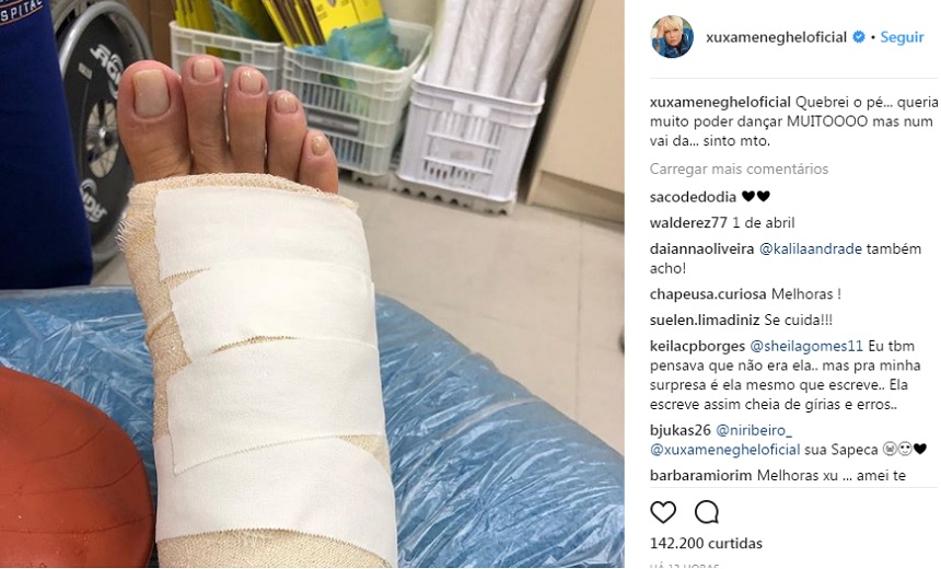 &#8220;Queria dançar muito, mas não vai dar&#8221;, lamenta Xuxa nas redes sociais depois de quebrar o pé