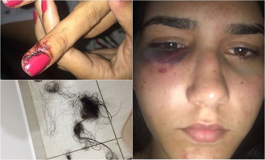 Jovem diz ter sido agredida por filho de prefeito baiano; caso foi exposto no facebook