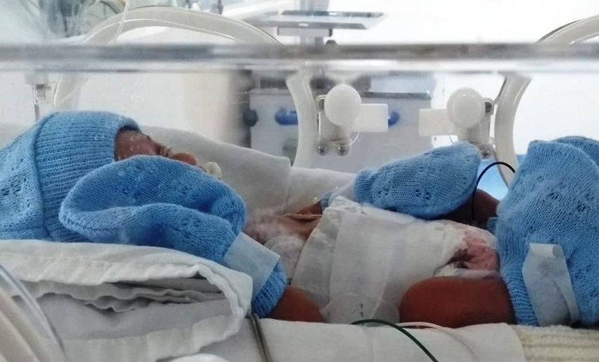Bebe Que Nasceu No Hgrs Com 500 Gramas Chega Aos Dois Meses Pesando 1 45 Kg Aratu On