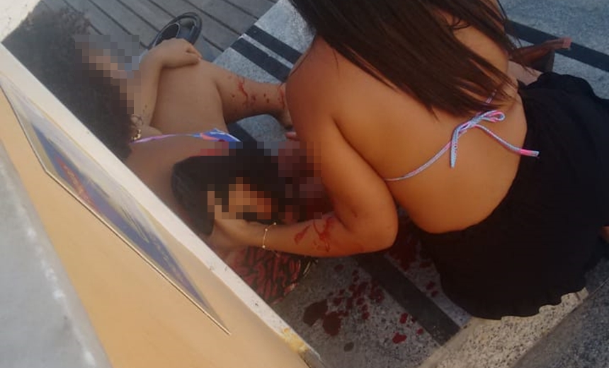 Mulher baleada com três tiros durante tiroteio foi atingida acidentalmente