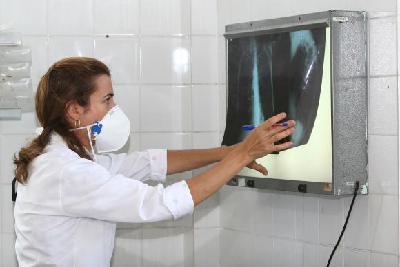 Suspensão de tratamento da tuberculose pode fortalecer doença, diz especialista