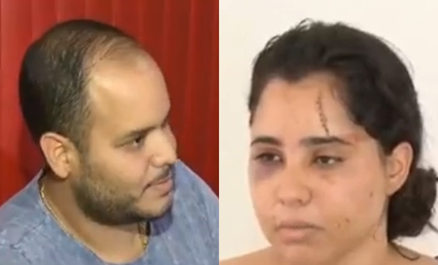 Mulher acusa DJ de agressão em Salvador; &#8220;jogou vidro na minha cabeça&#8221;