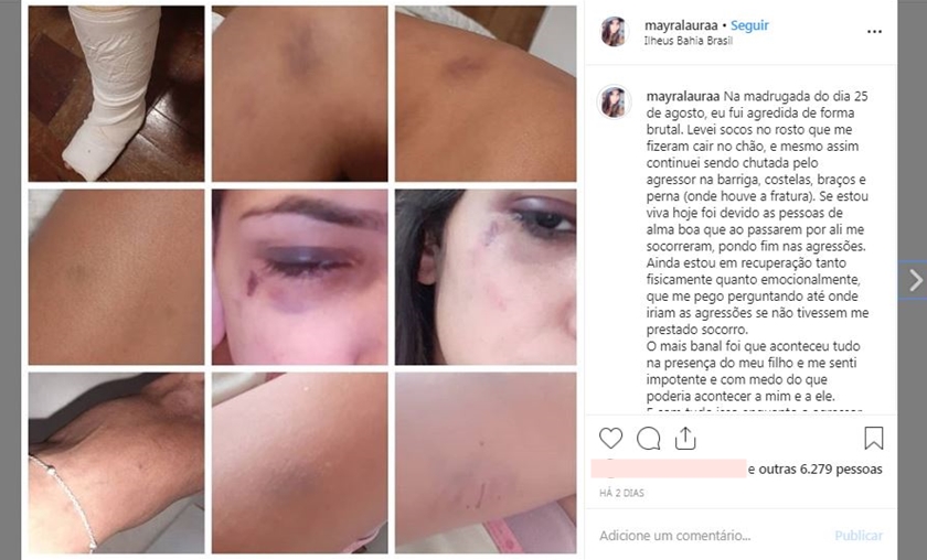 Mulher denuncia ex-marido que a agrediu na frente do filho