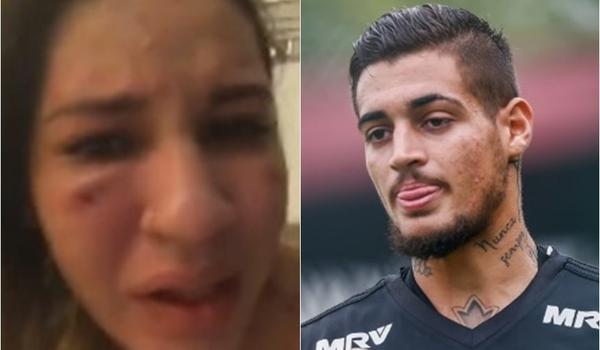 Em vídeo, esposa de ex-goleiro do Bahia diz que foi espancada pelo marido; "quero justiça!"