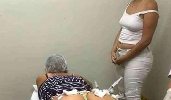 "Mamãe do bumbum" é presa por usar silicone industrial e fechar com cola