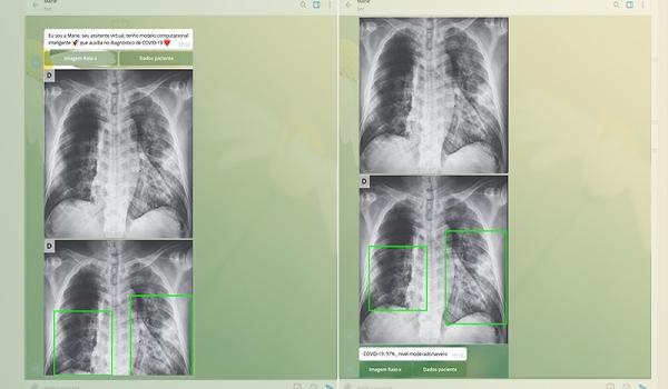 Pesquisadores da USP desenvolvem aplicativo que identifica Covid-19 através de raio-X