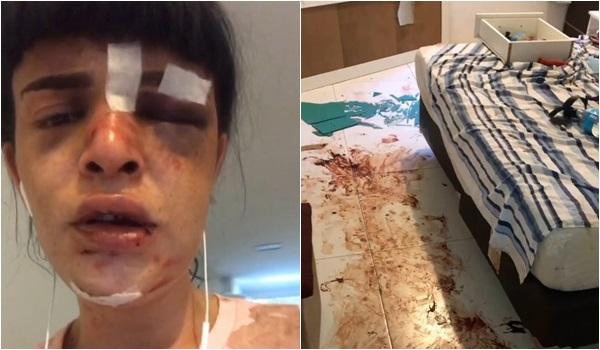 Mulher trans afirma ter sido agredida após marcar encontro; "pedi que ele não me matasse"