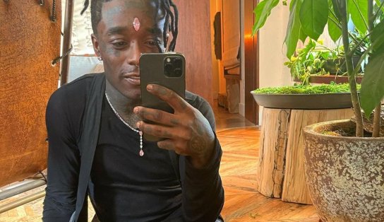 Lil Uzi retira diamante rosa de R$ 130 milhões que tinha implantado no rosto