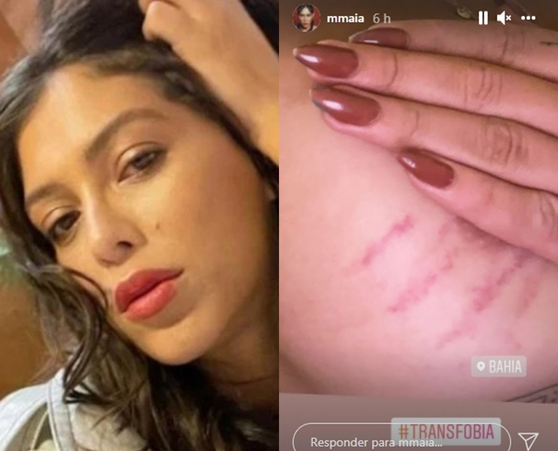 Atriz transexual é agredida em viagem a Bahia e faz vídeo mostrando hematomas: “Transfobia”