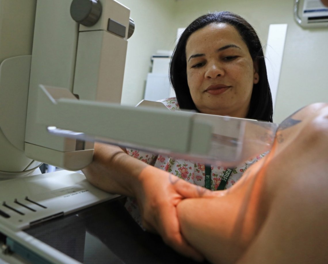Mil mamografias de graça em Salvador: onde marcar e como conseguir? Respondemos para você