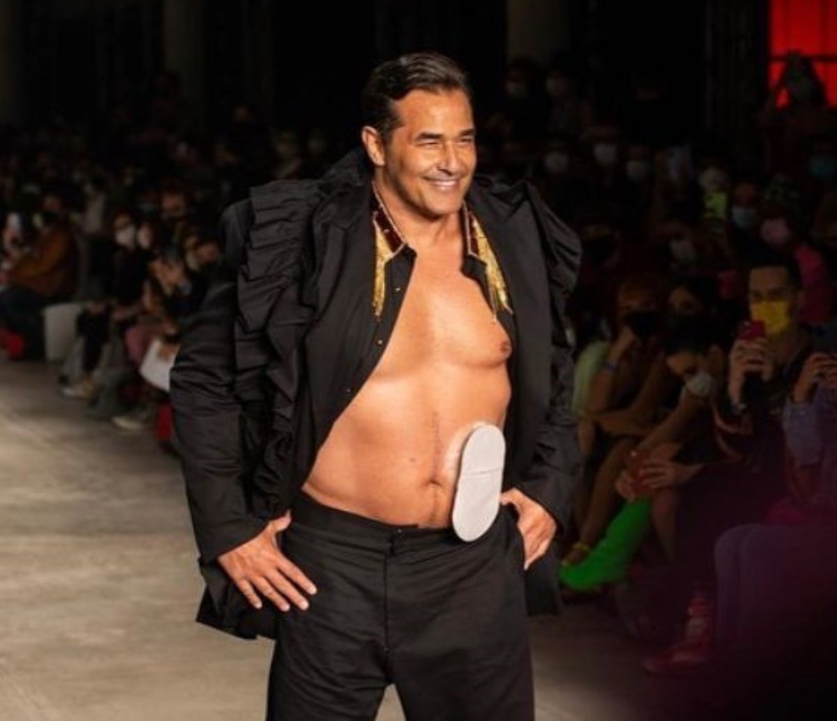 Luciano Szafir desfila na São Paulo Fashion Week com bolsa de estomia: "Não define ninguém"