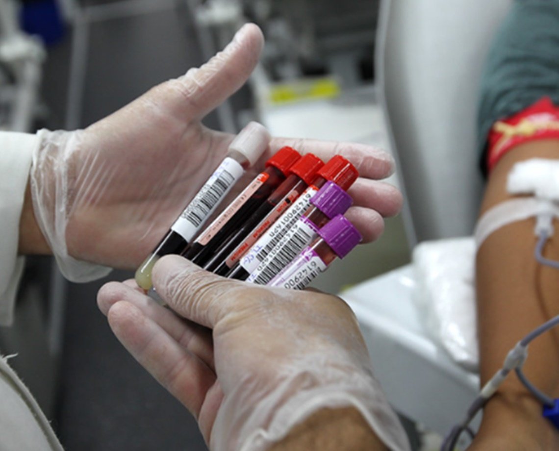 Hemoba adota novos critérios para doação de sangue em relação a infecções por Covid-19; confira