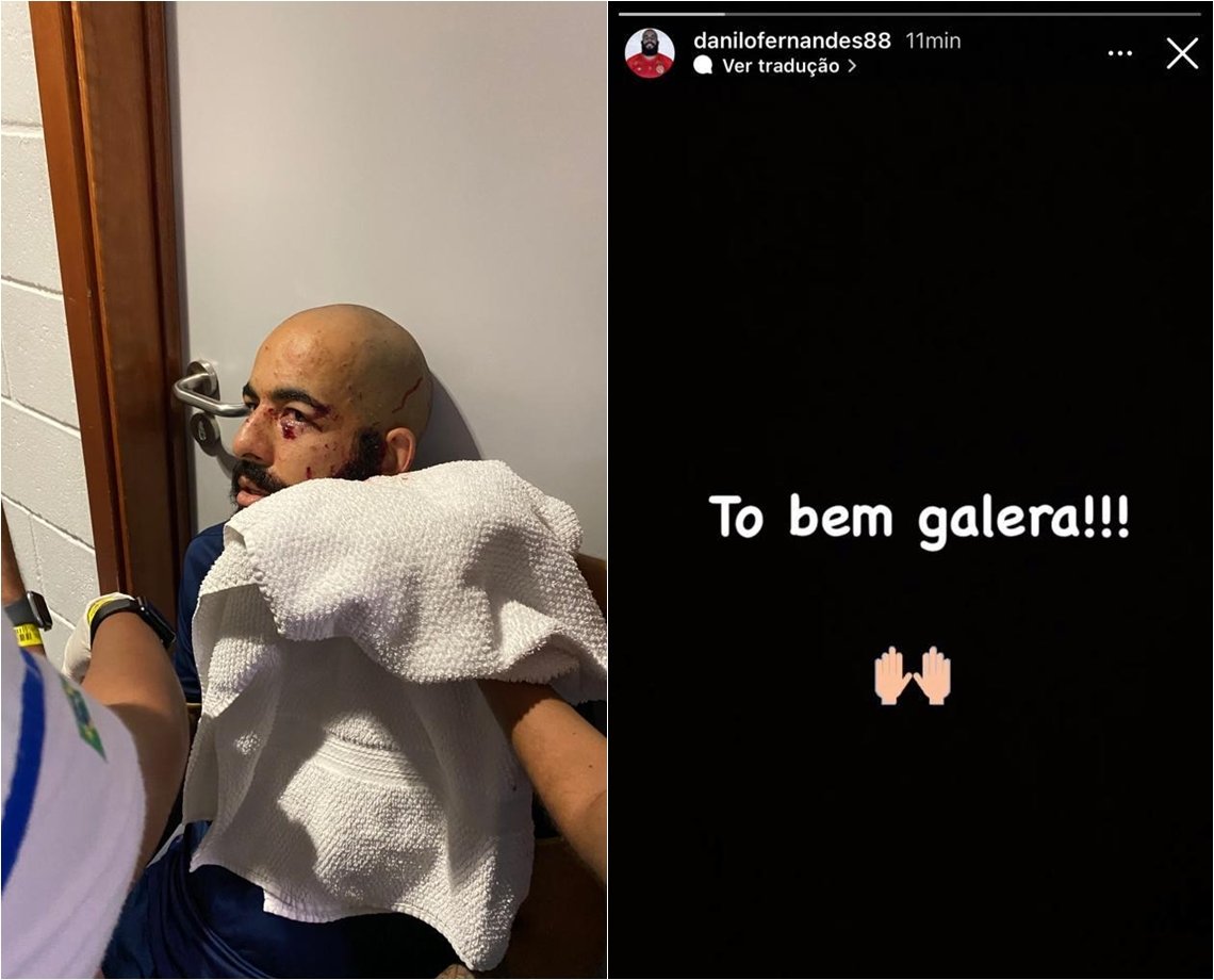 Danilo Fernandes, ferido no ataque ao ônibus do Bahia, avisa aos torcedores: "estou bem, galera!"