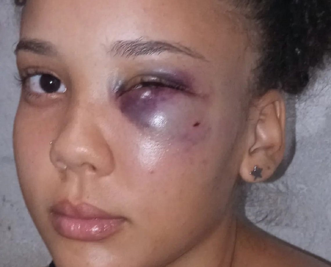 Cantor de trap é acusado de agredir namorada de 19 anos após descobrir sexo enquanto estavam separados; "apertou meu pescoço"