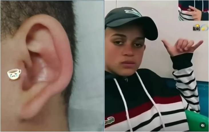 Jovem de 14 anos tem complicações na colocação de piercing, descobre problema no pulmão por uso de narguilé e morre no hospital