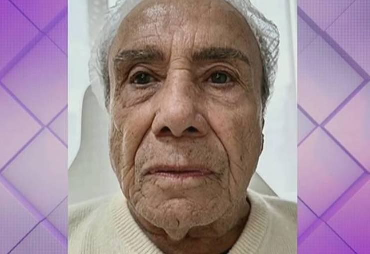 Stênio Garcia faz harmonização facial aos 91 anos; veja antes e depois