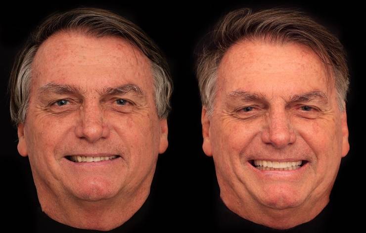 'Rindo à toa': Bolsonaro faz harmonização dentária de mais de R$ 80 mil