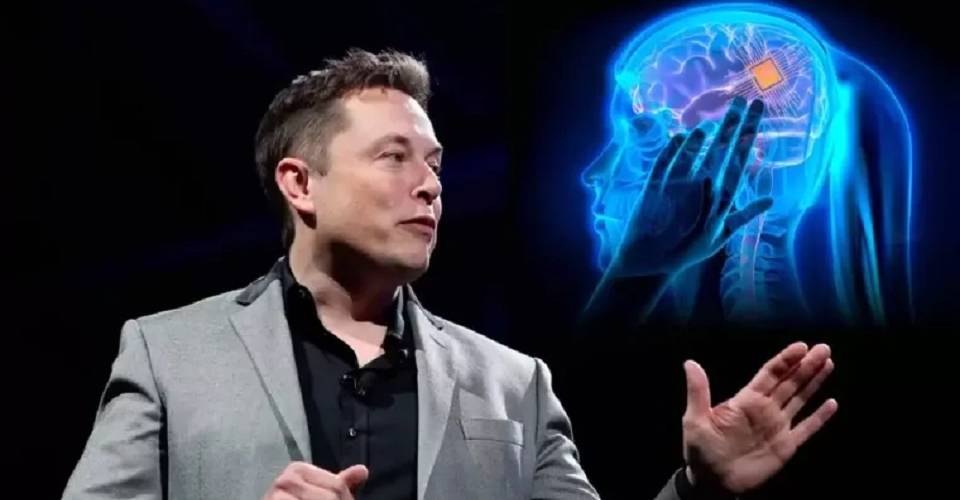 Elon Musk anuncia primeiro implante de chip cerebral em ser humano e garante sucesso