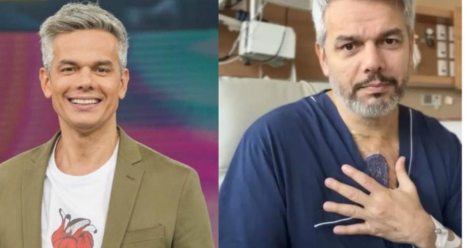 Otaviano Costa passa por cirurgia após diagnóstico de aneurisma de aorta